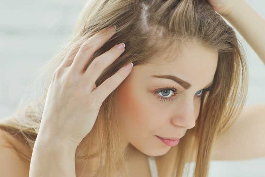 pelucas y postizos para alopecia femenina